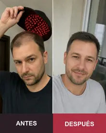 Resultado antes y después de un cliente