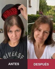 Resultado antes y después de una clienta